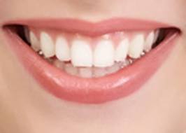 smiling teeth 4465 